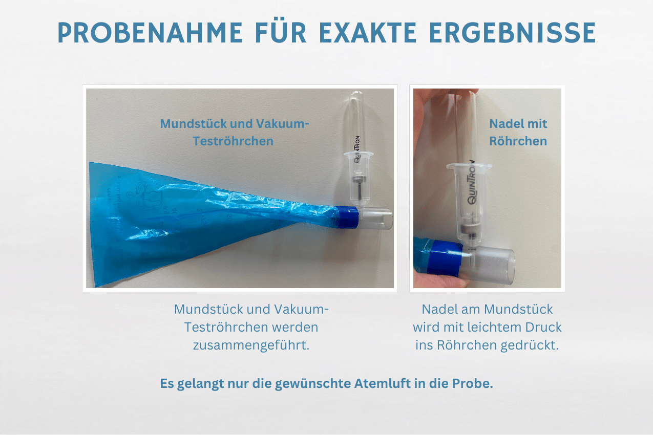 Atemtest SIBO Fructose